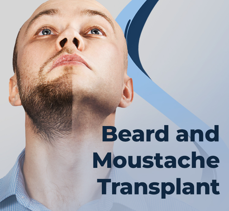 Beard and Moustache Transplantation